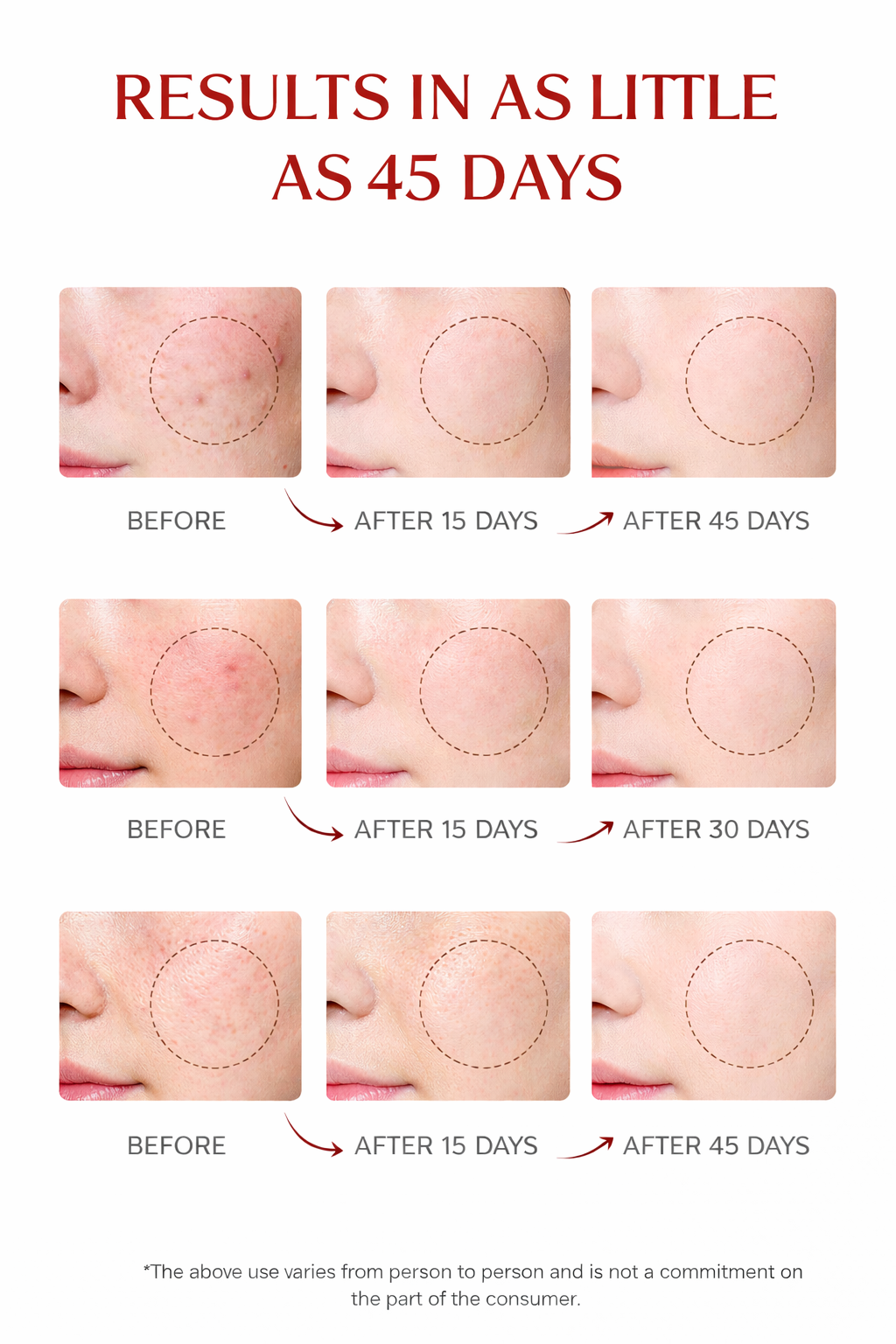 Red Light Therapy Panel